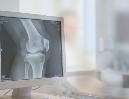 Digitales Röntgen